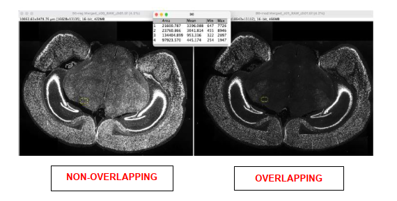 A close-up of a mri

Description automatically generated